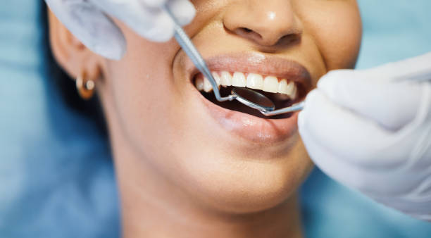 Best Emergency Dental Filling Replacement  in Worland, WY