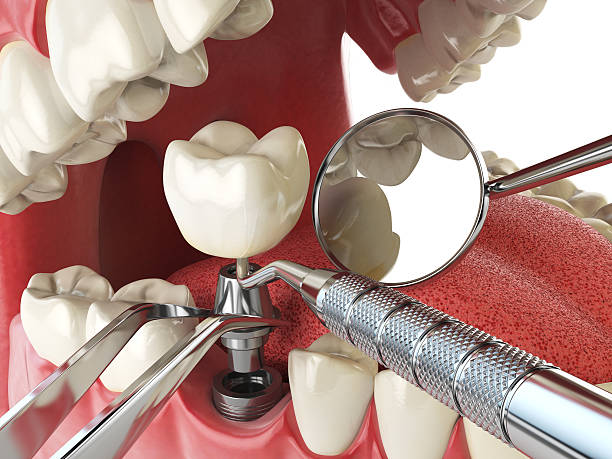 Best Urgent Tooth Repair  in Worland, WY